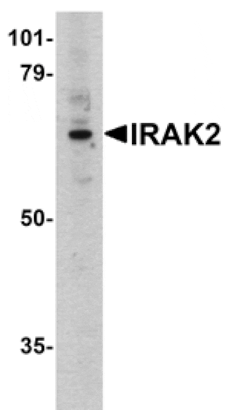 Western blot - IRAK-2 Antibody from Signalway Antibody (24084) - Antibodies.com