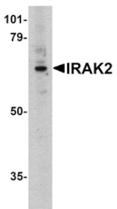 Western blot - IRAK-2 Antibody from Signalway Antibody (24084) - Antibodies.com