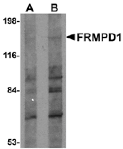 Western blot - FRMPD1 Antibody from Signalway Antibody (24991) - Antibodies.com