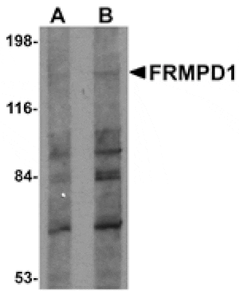 Western blot - FRMPD1 Antibody from Signalway Antibody (24991) - Antibodies.com