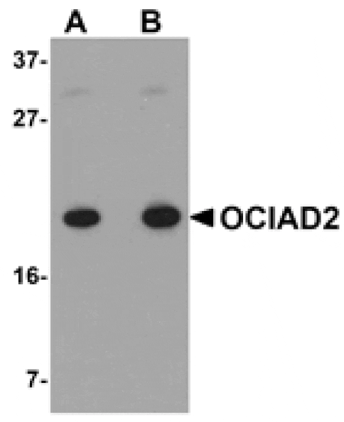 Western blot - OCIAD2 Antibody from Signalway Antibody (24996) - Antibodies.com