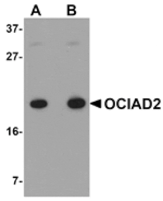 Western blot - OCIAD2 Antibody from Signalway Antibody (24996) - Antibodies.com
