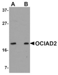 Western blot - OCIAD2 Antibody from Signalway Antibody (24997) - Antibodies.com