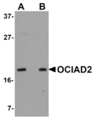 Western blot - OCIAD2 Antibody from Signalway Antibody (24997) - Antibodies.com