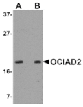 Western blot - OCIAD2 Antibody from Signalway Antibody (24997) - Antibodies.com
