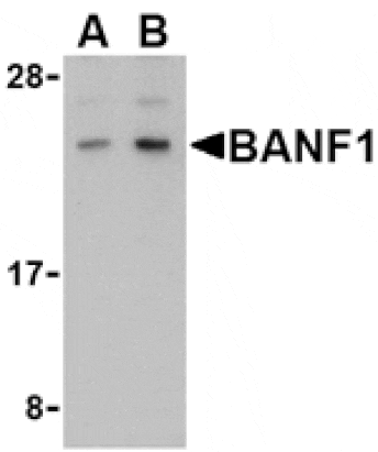 Western blot - BANF1 Antibody from Signalway Antibody (24484) - Antibodies.com