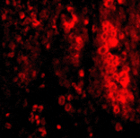 Immunofluorescence - IL-33 Antibody from Signalway Antibody (24550) - Antibodies.com