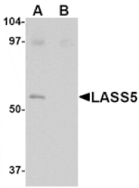 Western blot - LASS5 Antibody from Signalway Antibody (24718) - Antibodies.com