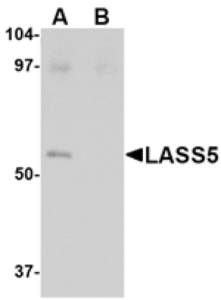 Western blot - LASS5 Antibody from Signalway Antibody (24718) - Antibodies.com
