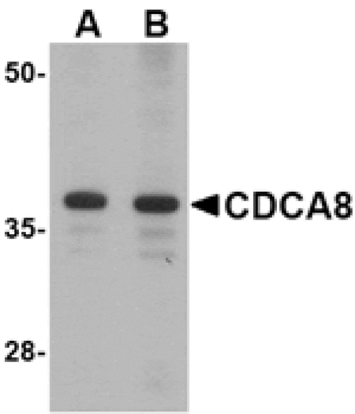 Western blot - CDCA8 Antibody from Signalway Antibody (24735) - Antibodies.com