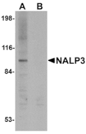 Western blot - NALP3 Antibody from Signalway Antibody (24988) - Antibodies.com