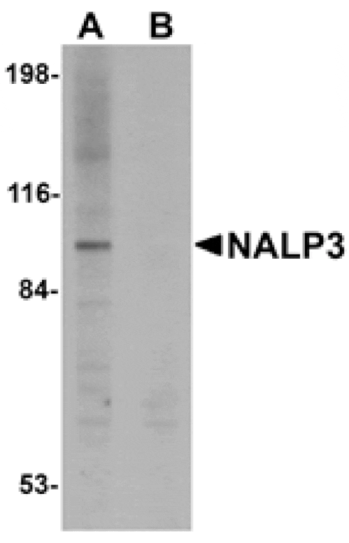 Western blot - NALP3 Antibody from Signalway Antibody (24988) - Antibodies.com