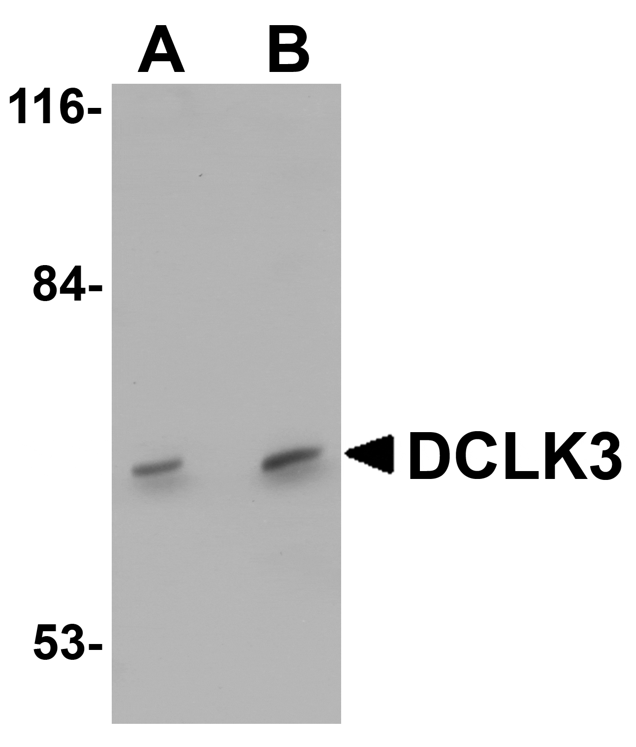 Western blot analysis of DCLK3 in K562 cell lysate with DCLK3 antibody at (A) 1 and (B) 2 µg/mL.