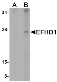 Western blot - EFHD1 Antibody from Signalway Antibody (25076) - Antibodies.com