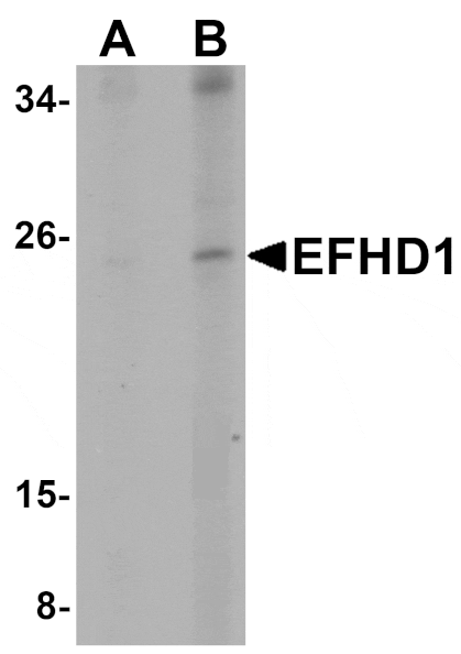 Western blot - EFHD1 Antibody from Signalway Antibody (25076) - Antibodies.com