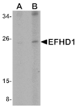 Western blot - EFHD1 Antibody from Signalway Antibody (25076) - Antibodies.com
