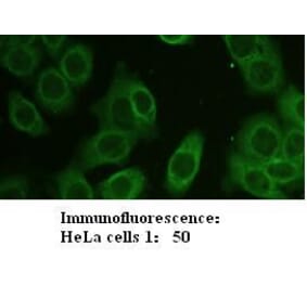 Zyxin Antibody from Signalway Antibody (39205) - Antibodies.com