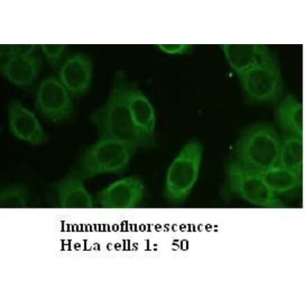 Zyxin Antibody from Signalway Antibody (39205) - Antibodies.com