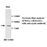 Zyxin Antibody from Signalway Antibody (39205) - Antibodies.com