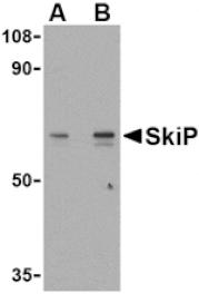 Western blot - SkiP Antibody from Signalway Antibody (24103) - Antibodies.com