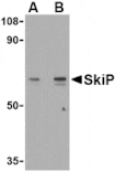 Western blot - SkiP Antibody from Signalway Antibody (24103) - Antibodies.com