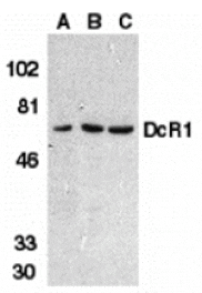 Western blot - DcR1 Antibody from Signalway Antibody (24113) - Antibodies.com