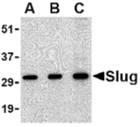 Western blot - Slug Antibody from Signalway Antibody (24463) - Antibodies.com
