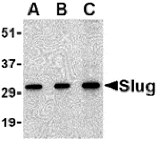 Western blot - Slug Antibody from Signalway Antibody (24463) - Antibodies.com