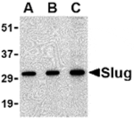 Western blot - Slug Antibody from Signalway Antibody (24463) - Antibodies.com