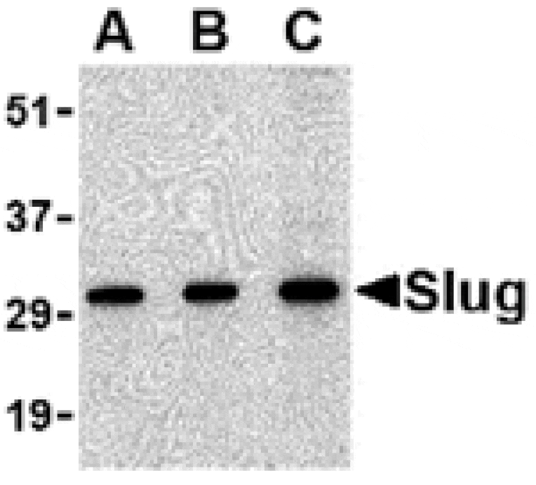 Western blot - Slug Antibody from Signalway Antibody (24463) - Antibodies.com