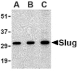 Western blot - Slug Antibody from Signalway Antibody (24463) - Antibodies.com