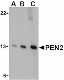 Western blot - PEN2 Antibody from Signalway Antibody (24469) - Antibodies.com