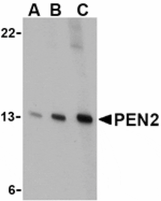 Western blot - PEN2 Antibody from Signalway Antibody (24469) - Antibodies.com