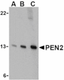 Western blot - PEN2 Antibody from Signalway Antibody (24469) - Antibodies.com