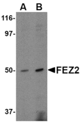 Western blot - FEZ2 Antibody from Signalway Antibody (24609) - Antibodies.com