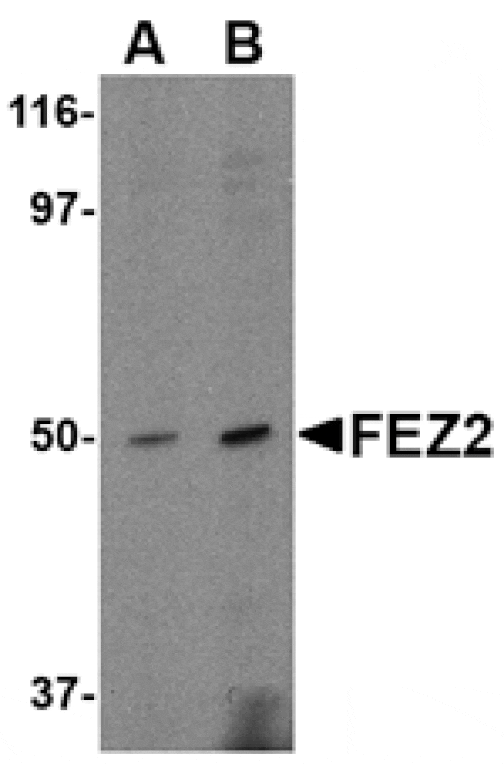 Western blot - FEZ2 Antibody from Signalway Antibody (24609) - Antibodies.com