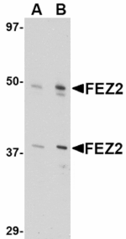 Western blot - FEZ2 Antibody from Signalway Antibody (24610) - Antibodies.com
