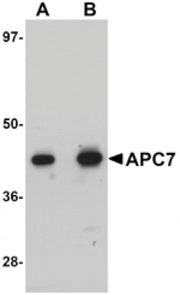 Western blot - APC7 Antibody from Signalway Antibody (25106) - Antibodies.com