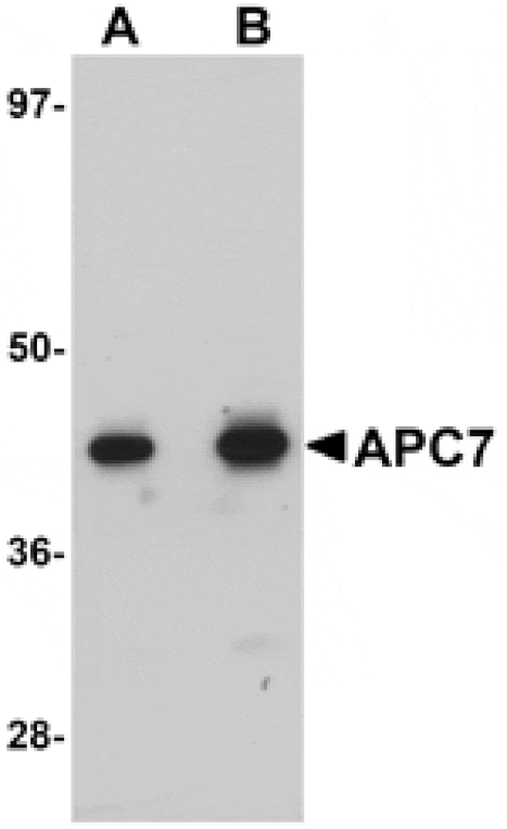 Western blot - APC7 Antibody from Signalway Antibody (25106) - Antibodies.com