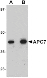 Western blot - APC7 Antibody from Signalway Antibody (25106) - Antibodies.com