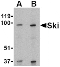 Western blot - Ski Antibody from Signalway Antibody (24102) - Antibodies.com