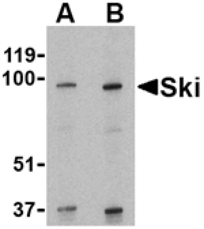 Western blot - Ski Antibody from Signalway Antibody (24102) - Antibodies.com