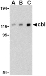 Western blot - Cbl Antibody from Signalway Antibody (24466) - Antibodies.com