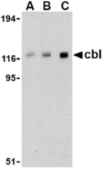 Western blot - Cbl Antibody from Signalway Antibody (24466) - Antibodies.com