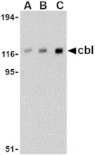 Western blot - Cbl Antibody from Signalway Antibody (24466) - Antibodies.com