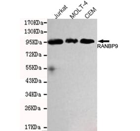 Western blot - RANBP9 Monoclonal Antibody from Signalway Antibody (27107) - Antibodies.com
