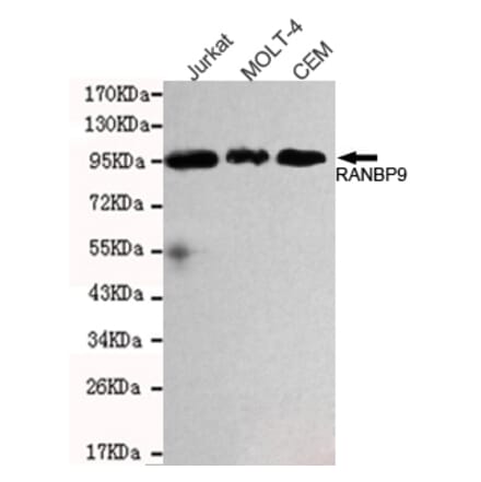Western blot - RANBP9 Monoclonal Antibody from Signalway Antibody (27107) - Antibodies.com