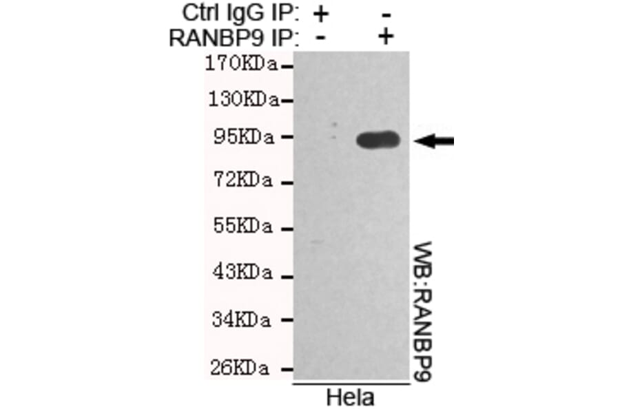 Immunoprecipitation - RANBP9 Monoclonal Antibody from Signalway Antibody (27107) - Antibodies.com