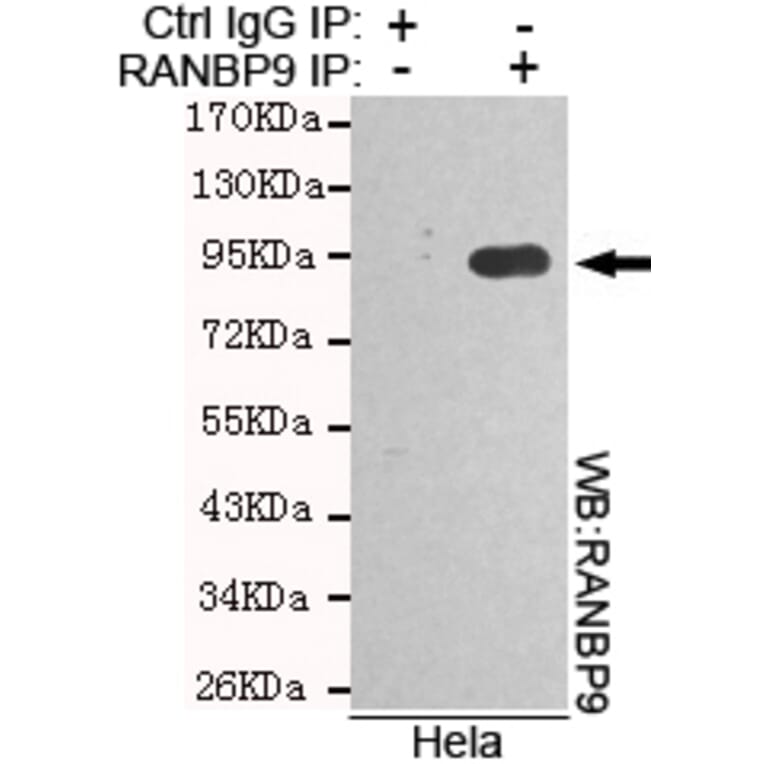 Immunoprecipitation - RANBP9 Monoclonal Antibody from Signalway Antibody (27107) - Antibodies.com