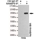 Immunoprecipitation - RANBP9 Monoclonal Antibody from Signalway Antibody (27107) - Antibodies.com